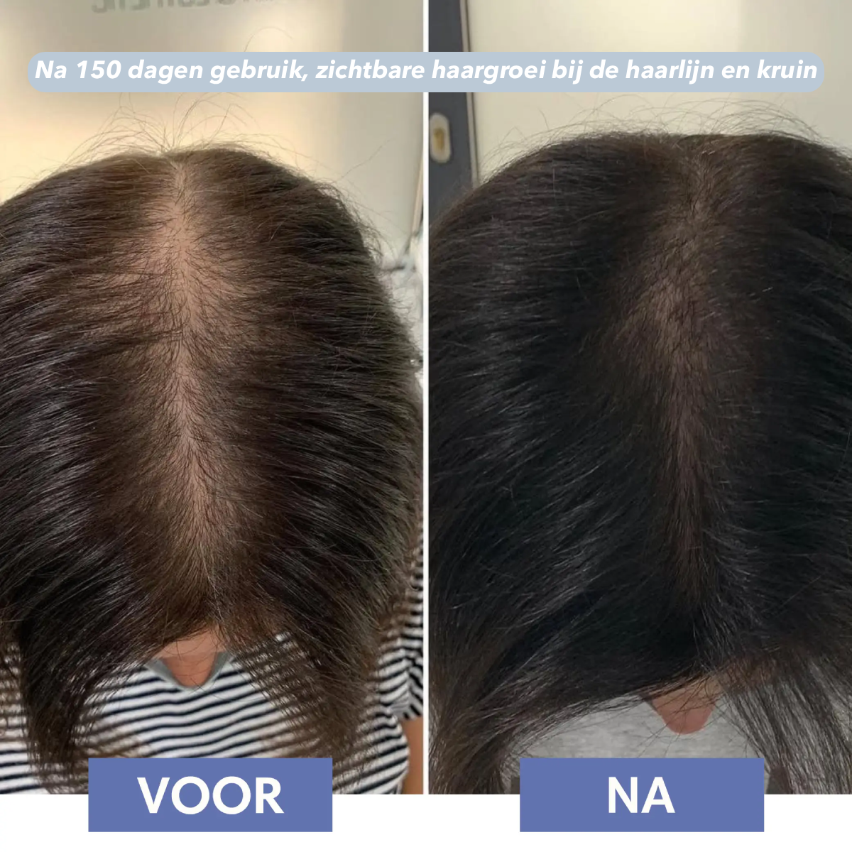 Scalp Activating Serum